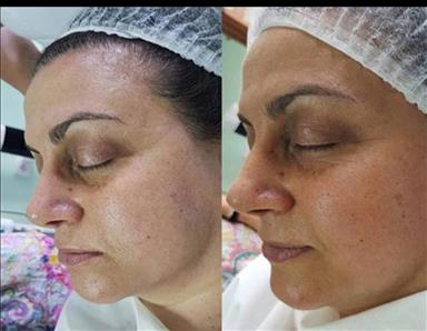 کلینیک زیبایی پاکسازی و فیشال فاطمه حبیبی  در  مشهد