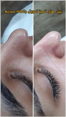 کلینیک زیبایی پاکسازی و فیشال فاطمه حبیبی  در  مشهد
