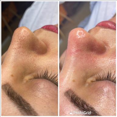 سالن زیبایی پاکسازی پوست  در  اصفهان