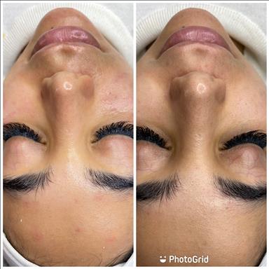 سالن زیبایی پاکسازی پوست  در  اصفهان