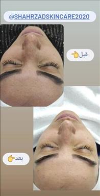 کلینیک زیبایی خدمات فشیال زحمتکش  در  مشهد