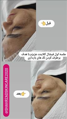 کلینیک زیبایی خدمات فشیال زحمتکش  در  مشهد