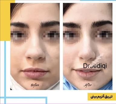 کلینیک زیبایی خدمات پوست سایه  در  مشهد