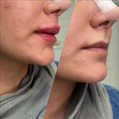 کلینیک زیبایی خدمات پوست سایه  در  مشهد