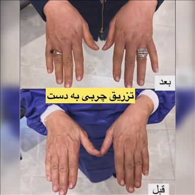 کلینیک زیبایی خدمات پوست سایه  در  مشهد