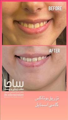 کلینیک زیبایی کلینیک تخصصی پوست ساحا   در  تهران