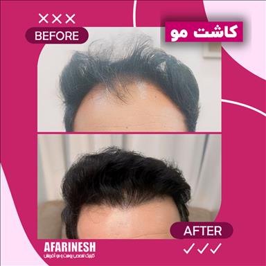 کلینیک زیبایی کلینیک زیبایی آفرینش  در  مشهد