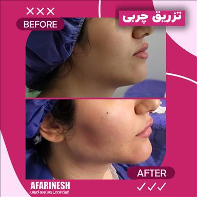 کلینیک زیبایی کلینیک زیبایی آفرینش  در  مشهد