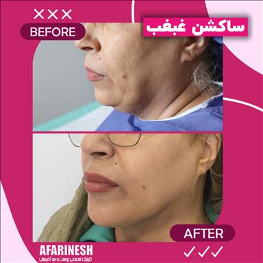 کلینیک زیبایی کلینیک زیبایی آفرینش  در  مشهد