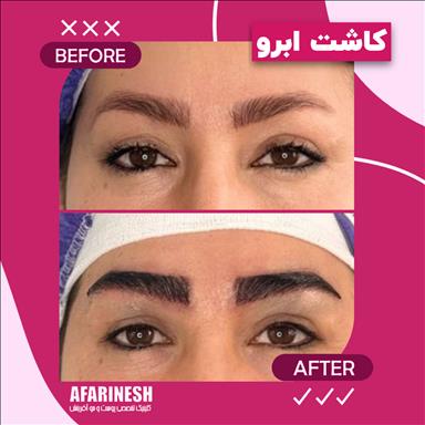 کلینیک زیبایی کلینیک زیبایی آفرینش  در  مشهد