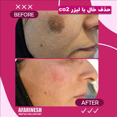 کلینیک زیبایی کلینیک زیبایی آفرینش  در  مشهد