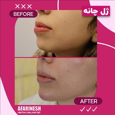 کلینیک زیبایی کلینیک زیبایی آفرینش  در  مشهد