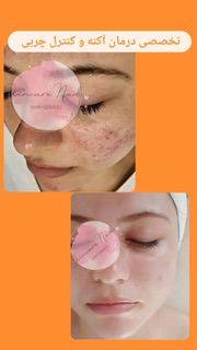 سالن زیبایی سالن زیبایی آپامه  در  رشت