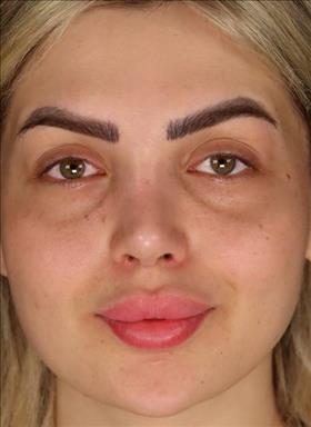 سالن زیبایی لونا بیوتی  در  مشهد