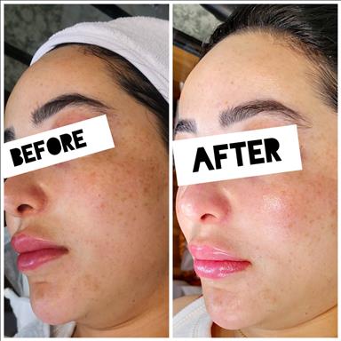 سالن زیبایی فیشیال درمانی پارلا  در  تهران