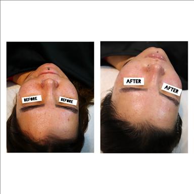 سالن زیبایی فیشیال درمانی پارلا  در  تهران