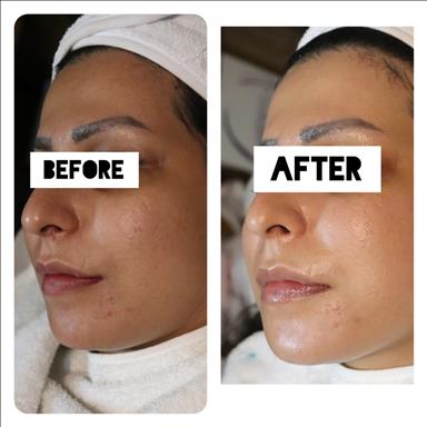 سالن زیبایی فیشیال درمانی پارلا  در  تهران