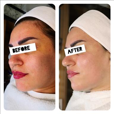 سالن زیبایی فیشیال درمانی پارلا  در  تهران