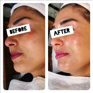 سالن زیبایی فیشیال درمانی پارلا  در  تهران