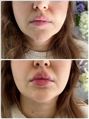 کلینیک زیبایی رویال وی ای پی   در  اصفهان