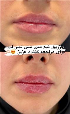 کلینیک زیبایی رویال وی ای پی   در  اصفهان