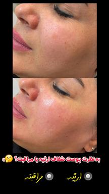 سالن زیبایی زیبایی قصر عروس  در  چابهار