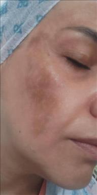 کلینیک زیبایی فیشال عادله سعادتمند  در  مشهد