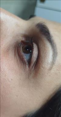 کلینیک زیبایی فیشال عادله سعادتمند  در  مشهد