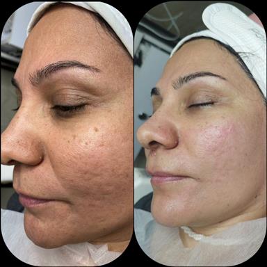 کلینیک زیبایی فیشال عادله سعادتمند  در  مشهد