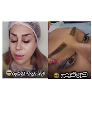 سالن زیبایی ارایش دائم صورت و ریموو تتو  در  بیرجند