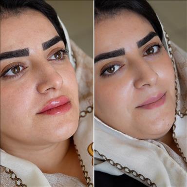 کلینیک زیبایی کلینیک ماهک  در  آمل