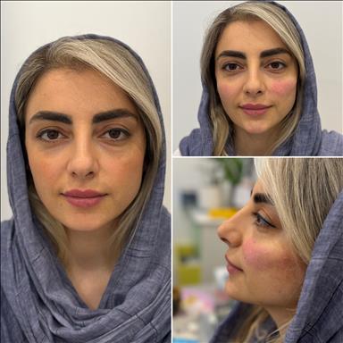 کلینیک زیبایی کلینیک ماهک  در  آمل