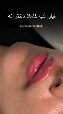 کلینیک زیبایی ماه و خورشید  در  کرج