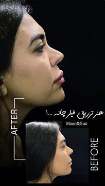 کلینیک زیبایی ماه و خورشید  در  کرج