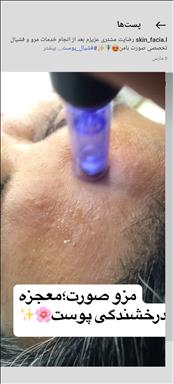 کلینیک زیبایی  پاک سازی و فیشال عرب پور  در  چالوس