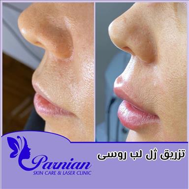 کلینیک زیبایی کلینیک پوست ومو دکتر شقایق( پرنیان )  در  مشهد