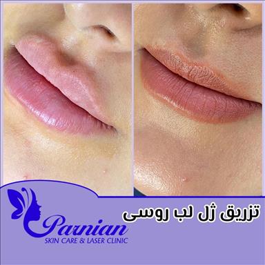 کلینیک زیبایی کلینیک پوست ومو دکتر شقایق( پرنیان )  در  مشهد