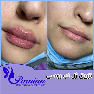 کلینیک زیبایی کلینیک پوست ومو دکتر شقایق( پرنیان )  در  مشهد