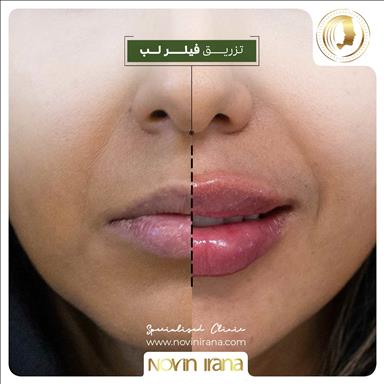 کلینیک زیبایی کلینیک زیبایی نوین ایرانا  در  مشهد