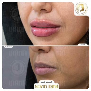 کلینیک زیبایی کلینیک زیبایی نوین ایرانا  در  مشهد