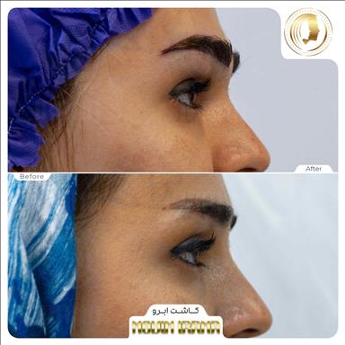 کلینیک زیبایی کلینیک زیبایی نوین ایرانا  در  مشهد