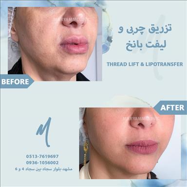 کلینیک زیبایی کلینیک زیبایی پوست و مو مریم   در  مشهد