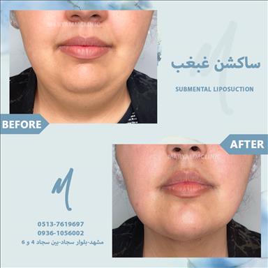 کلینیک زیبایی کلینیک زیبایی پوست و مو مریم   در  مشهد