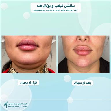 کلینیک زیبایی کلینیک زیبایی پوست و مو مریم   در  مشهد