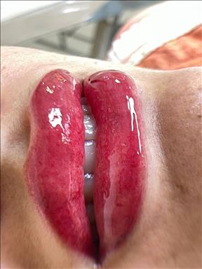 سالن زیبایی میکروبلیدینگ منیره رضاپور  در  مشهد