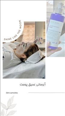 سالن زیبایی اتاق پوست بیتا  در  مشهد