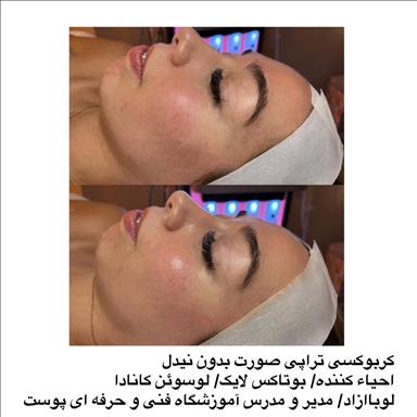 سالن زیبایی آموزشگاه پوست و مو و زیبایی لوبا آزاد  در  مشهد