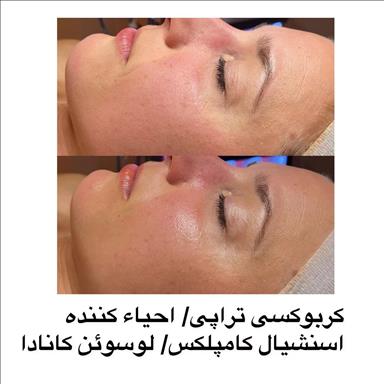 سالن زیبایی آموزشگاه پوست و مو و زیبایی لوبا آزاد  در  مشهد