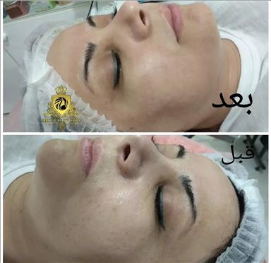 سالن زیبایی پنجه ی آفتاب  در  بندر انزلی