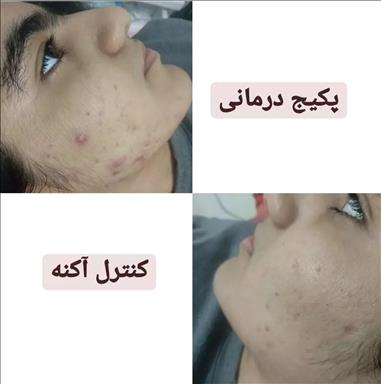 سالن زیبایی پنجه ی آفتاب  در  بندر انزلی